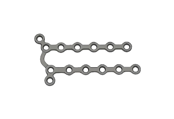 Блокуюча пластина для задньої поверхні дистального відділу променевої кістки Jinlu